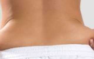 Как избежать обвисания кожи при быстром похудении