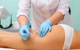 Озон для похудения сколько процедур