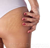 После похудения начала резко набирать вес