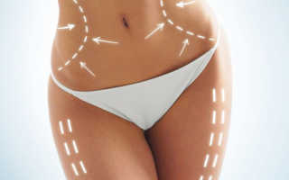 Поможет ли липосакция похудеть