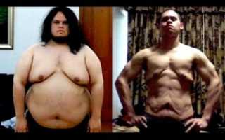 Обвисшая кожа после похудения уже год что делать