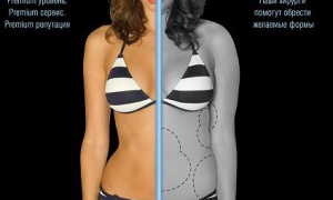 Пластические операции для похудения