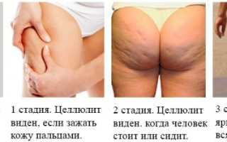 Оранжевая серия кремов для похудения