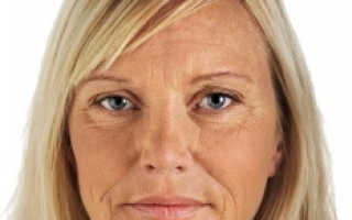 Восстановится ли кожа лица после похудения