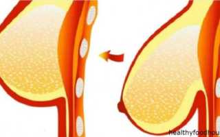 Потеря груди при похудении