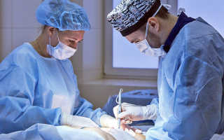 Впалые глаза при похудении